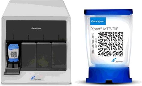 mtb not detected|Xpert®MTB/RIF’(Cepheid)’ .